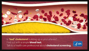 cholesterol